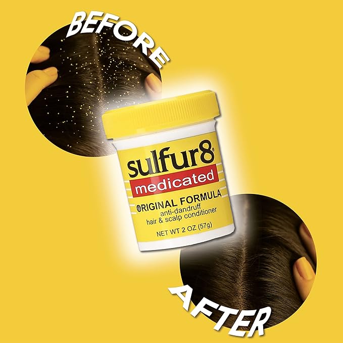 Sulfur 8 Medicated Original Formula Anti-Dandruff Hair and Scalp Conditioner x-pression
