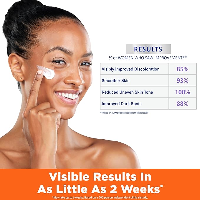 Palmer's Skin Success Anti-Dark Spot Nighttime Fade Cream with Retinol & Niacinamide, Dark Spot Corrector for Face, Night Moisturizer Helps Reduce Dark Spots, Fine Lines & Wrinkles, 2.7 Ounce x-pression