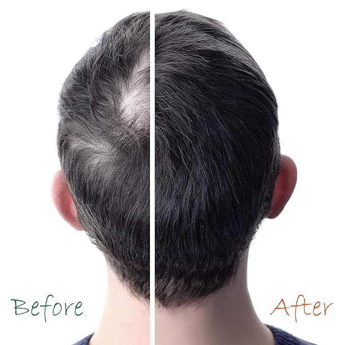 Organic Hair Energizer Hair Growth Booster , 6 Oz x-pression